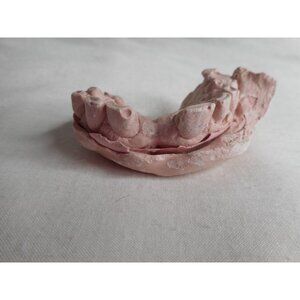 Vintage Cast Dental Teeth Mold Tooth Castings #10